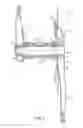 Fig. 03 - Bicycle crank assembly