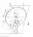 Fig. 06 - Saw blade stabilizer and method