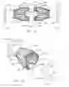 Fig. 02 - Peeling cup for fruit juice extraction device