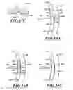Fig. 09 - Susceptor support system