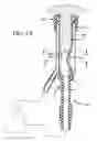 Fig. 10 - Milking liner