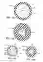 Fig. 18 - Milking liner