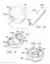 Fig. 28 - Animal toy with squeaker