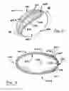 Fig. 40 - Animal toy with squeaker