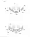 Fig. 11 - Hydraulic lash adjuster for internal combustion engine