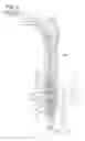 Fig. 03 - Fuel injection device