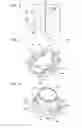 Fig. 04 - Aerosol medication inhalation system