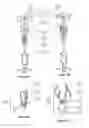 Fig. 06 - Methods and devices for conduit occlusion