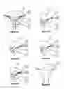 Fig. 07 - Methods and devices for conduit occlusion