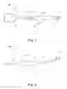 Fig. 03 - Dental Care Device