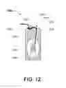 Fig. 11 - Dental Care Device