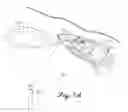 Fig. 02 - Bubble weapon system and methods for inhibiting movement and disrupting operations of vessels