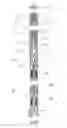 Fig. 01 - Method and apparatus for separating downhole hydrocarbons from water