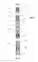 Fig. 02 - Method and apparatus for separating downhole hydrocarbons from water