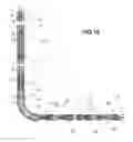 Fig. 11 - Method and apparatus for separating downhole hydrocarbons from water