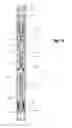 Fig. 14 - Method and apparatus for separating downhole hydrocarbons from water