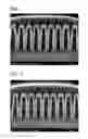Fig. 02 - Copper electrodeposition in microelectronics