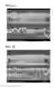 Fig. 12 - Copper electrodeposition in microelectronics