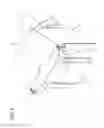 Fig. 10 - Dispensing canister for delivery of solid medications