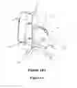 Fig. 10 - Device for distributing weight