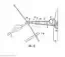 Fig. 09 - Hands free archery bow support