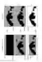 Fig. 07 - Multi level multileaf collimators