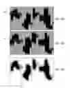 Fig. 08 - Multi level multileaf collimators
