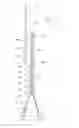Fig. 01 - METHOD AND APPARATUS FOR FABRICATION OF STRUCTURES USED IN CONSTRUCTION OF TOWER BASE SUPPORTS