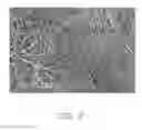 Fig. 03 - Method for making carbon nanotube composite wire structure
