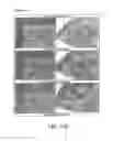 Fig. 16 - METHOD FOR LASER ENGRAVING FLEXOGRAPHIC PRINTING ARTICLES BASED ON MILLABLE POLYURETHANES