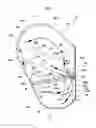 Fig. 03 - Side airbag device for vehicle