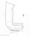 Fig. 05 - Furniture Lifting and Moving Device