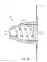Fig. 07 - Automotive collision energy dissipation device