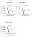 Fig. 14 - Acoustic wave resonator and duplexer using same