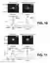 Fig. 08 - Extreme light pulse-front tilt and its application to single shot measurement of picosecond to nanosecond laser pulses