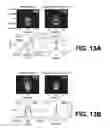 Fig. 10 - Extreme light pulse-front tilt and its application to single shot measurement of picosecond to nanosecond laser pulses