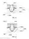 Fig. 19 - Zoom lens barrel