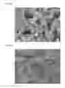 Fig. 05 - METHOD FOR FORMING ROUGHNESS ON SURFACE OF NUCLEAR FUEL ROD CLADDING INCLUDING ZIRCONIUM