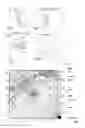 Fig. 02 - Method of bioimage data processing for revealing more meaningful anatomic features of diseased tissues