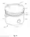 Fig. 09 - Liner with elastic securing mechanism