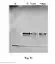Fig. 37 - BIOACTIVE COMPOSITIONS FROM THEACEA PLANTS AND PROCESSES FOR THEIR PRODUCTION AND USE