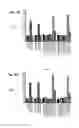 Fig. 04 - METHODS OF TREATING LUNG DISEASE AND OTHER INFLAMMATORY DISEASES