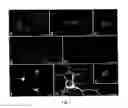 Fig. 02 - Multipotent neural stem cells