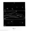 Fig. 07 - Multipotent neural stem cells