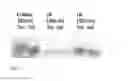 Fig. 07 - Enzyme-based fed-batch technique in liquid cultures