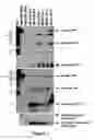 Fig. 02 - Method for diagnosing acute lymphomic leukemia (ALL) using miR-221