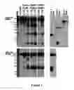 Fig. 04 - Method for diagnosing acute lymphomic leukemia (ALL) using miR-221