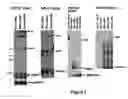 Fig. 08 - Method for diagnosing acute lymphomic leukemia (ALL) using miR-221