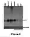 Fig. 09 - Method for diagnosing acute lymphomic leukemia (ALL) using miR-221