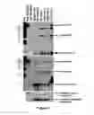Fig. 02 - Method for diagnosing acute lymphomic leukemia (ALL) using miR-146a